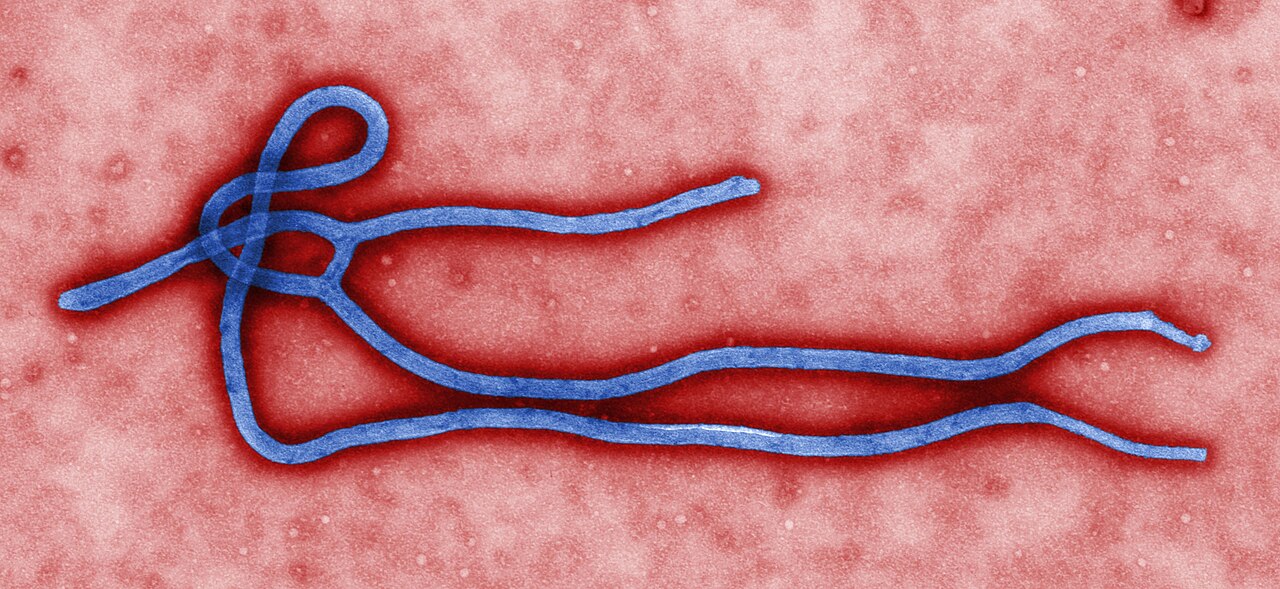 Colourised electron micrograph of an Ebola virus particle
